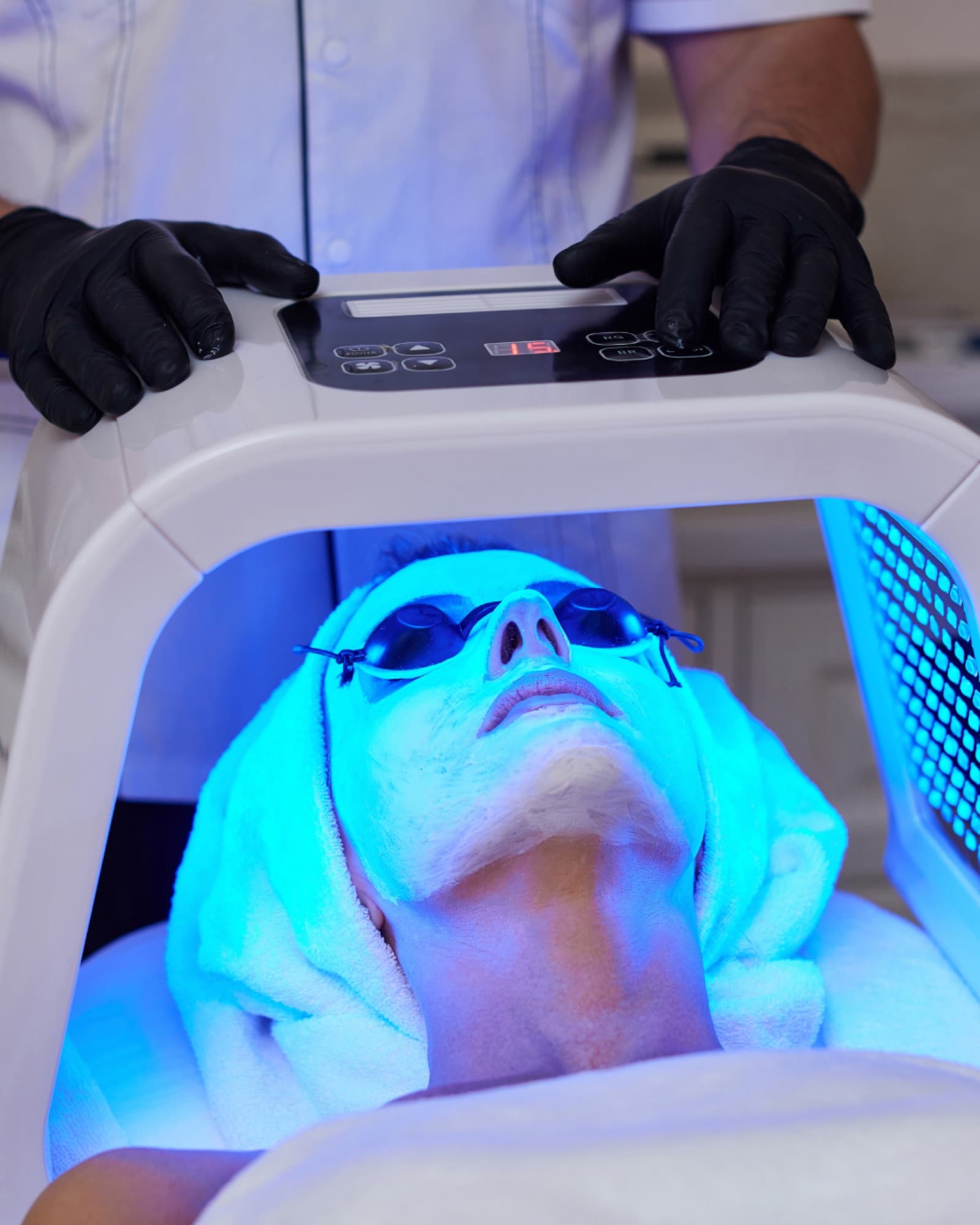 Tratamiento de manchas faciales con terapia de luz en el centro de Irene Ortiz
